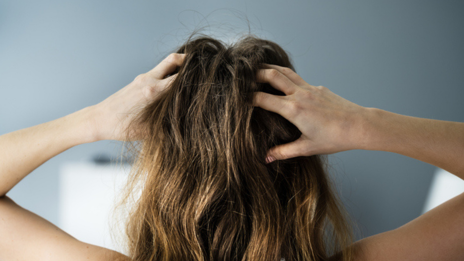 Does NMN Help with hair loss?