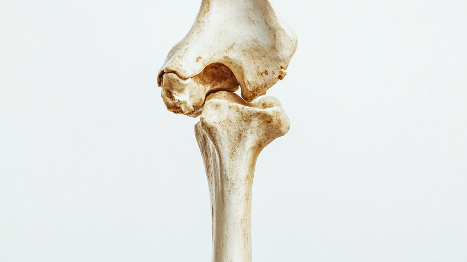 The Role of Bone Health in Living Longer