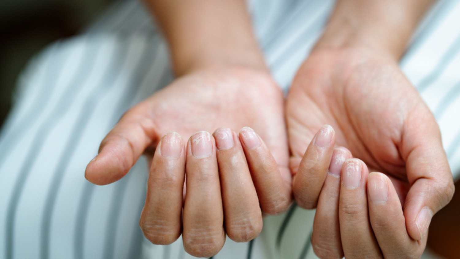 Your Fingernails Could Be Telling You Something About Ageing