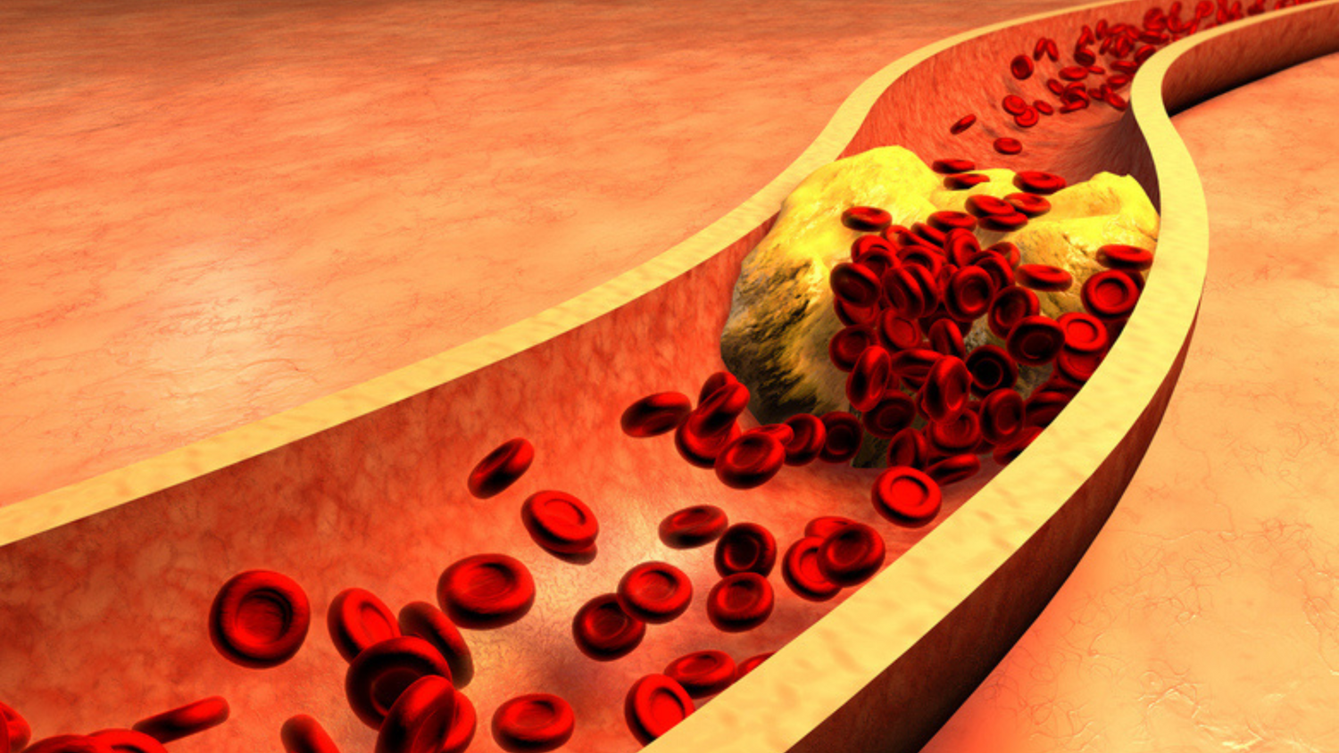Why ApoB Matters More Than Cholesterol for Heart Health and Healthy Ageing